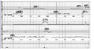 胎儿重度心动过缓分娩正常新生儿1例报告