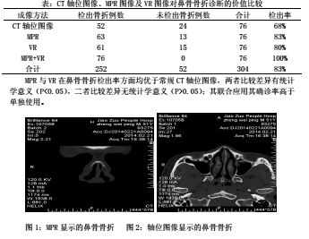 广州常年流动人口_广州各区人口图