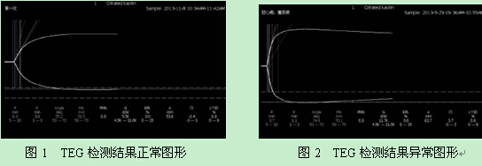 【摘要】目的:分析28例易发凝血功能紊乱疾病患者的血栓弹力图