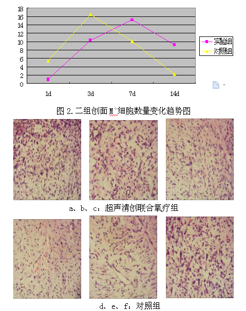 超声清创联合局部氧疗对肉芽创面炎症细胞的实