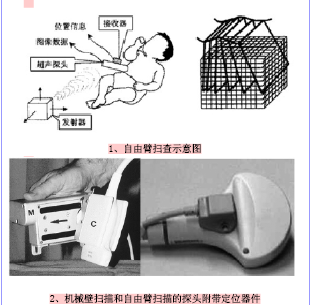 甲状腺腺瘤囊性变自由臂三维超声的诊断价值