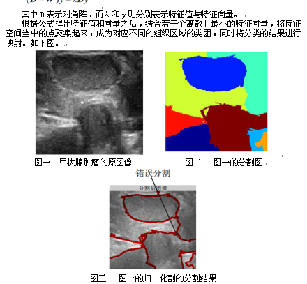 基于改进归一化割的甲状腺肿瘤B 超图像分割-