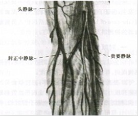 护士通常选取肘部三条主要静脉作为首选穿刺静脉,分别为肘正中静脉,贵