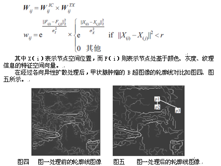 基于改进归一化割的甲状腺肿瘤B 超图像分割-