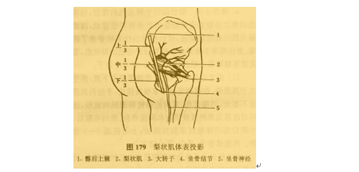 微针刀松解术配合减压手法治疗梨状肌综合征的