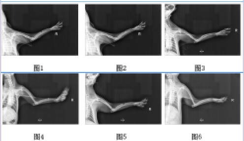 体外冲击波联合中草药刺激骨不连间隙骨痂形成机制的实验研究