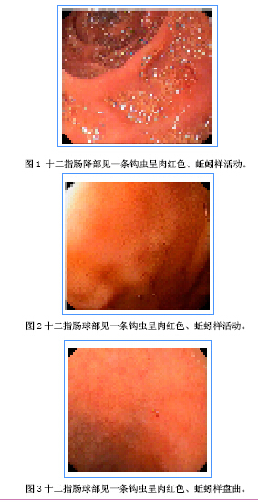 粪便常规镜下图谱