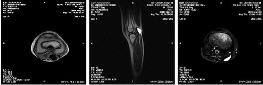 N׵mri