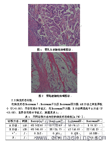 对比分析胃镜下活体组织检查与外科手术病理诊断胃癌疾病的临床价值