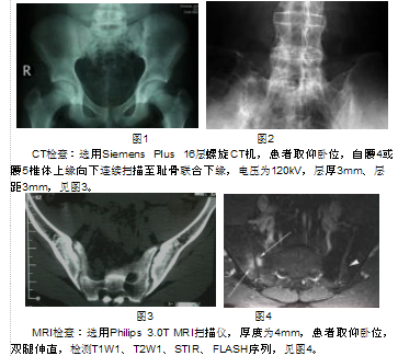 急性颅脑损伤中CT与MRI诊断价值比较