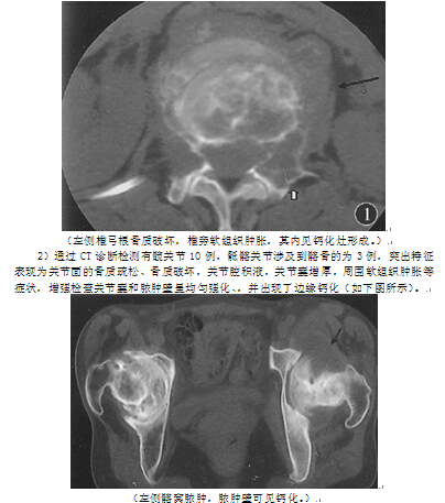 打印预览