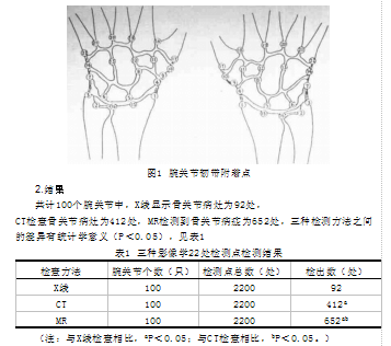 类风湿性关节炎腕关节病变的影像学分析X线、
