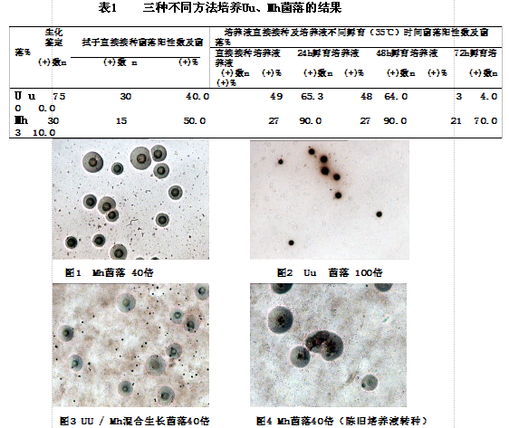 泌尿生殖道解脲脲原体和人型支原体菌落培养最