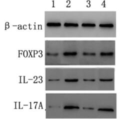 阿德福韦酯联合扶正化瘀胶囊抑制HBV及所致