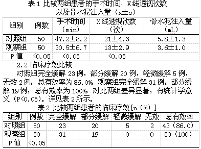 胸椎骨折应用单侧入路胸椎椎体成形术治疗的临