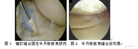 活血祛风法治疗白癜风的疗效分析